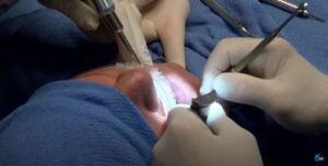 are in-house dental plans worth it