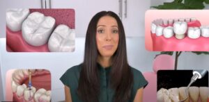 how long does numbness last after dental filling