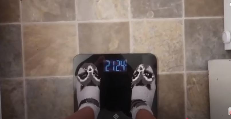 losing weight after wisdom teeth removal
